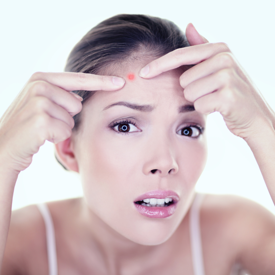 Verbasnol™ for Acne: A Botanical Approach to Clearer, Healthier Skin